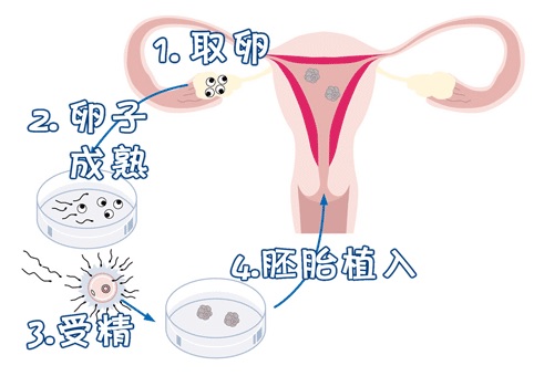 关于青碧生殖